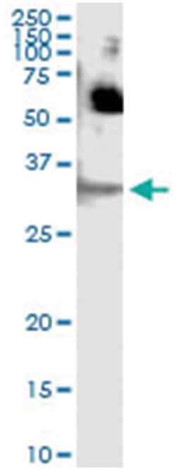 anti-SFN, Human, IP-WB Antibody Pair, Abnova&trade;