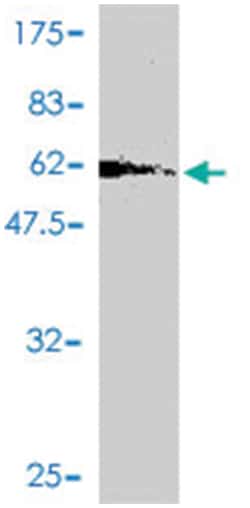 GPD2, Mouse, Polyclonal Antibody, Abnova 50&mu;L; Unlabeled:Antibodies,