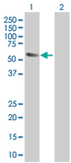 GPI 293T Cell Overexpression Lysate 2 (Denatured), Abnova 100 &mu;l | Buy Online | Abnova | Fisher Scientific