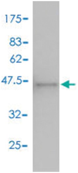 MKNK2, Mouse, Polyclonal Antibody, Abnova 50&mu;L; Unlabeled:Antibodies,