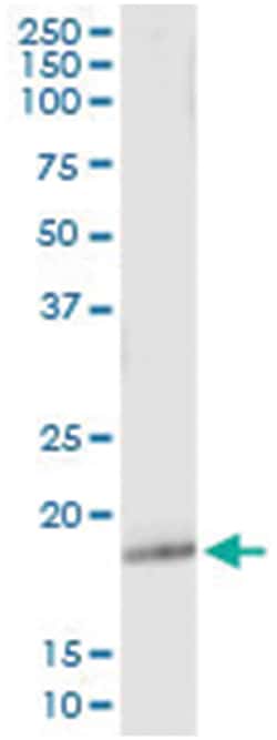 anti-GPX5, Human, IP-WB Antibody Pair, Abnova&trade;