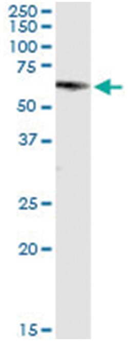 GRB7, Human, IP-WB Antibody Pair (PW2), Abnova™