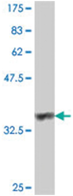 GRID1, Mouse, Polyclonal Antibody, Abnova 50 &mu;L | Buy Online | Abnova | Fisher Scientific