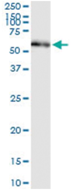 anti-PDIA3, Human, IP-WB Antibody Pair, Abnova 1 Set:Antibodies, Monoclonal/Polyclonal