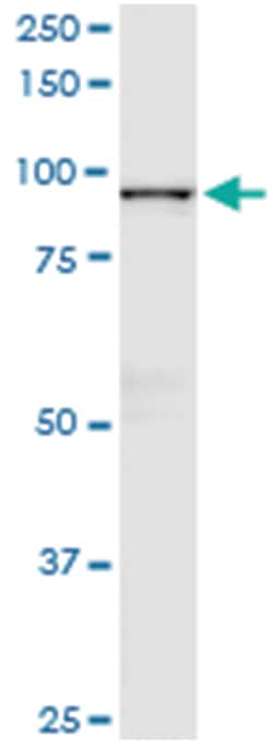 GSN, Human, IP-WB Antibody Pair (PW2), Abnova&trade;