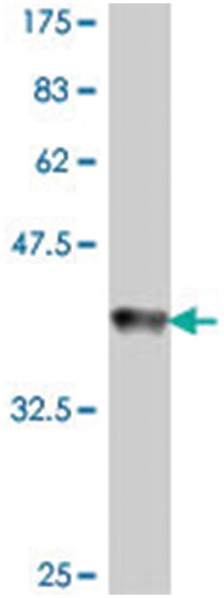 GSPT1, Mouse, Polyclonal Antibody, Abnova 50&mu;L; Unlabeled:Antibodies,