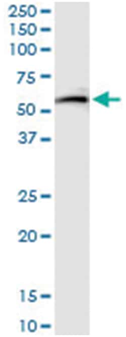 anti-GSR, Human, IP-WB Antibody Pair, Abnova&trade;