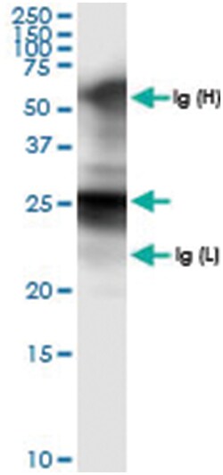 anti-GSTA1, Human, IP-WB Antibody Pair, Abnova&trade;