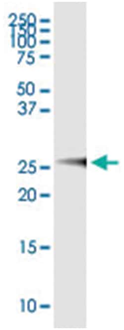 Abnova anti-GSTM4, Human, IP-WB Antibody Pair, Abnova™