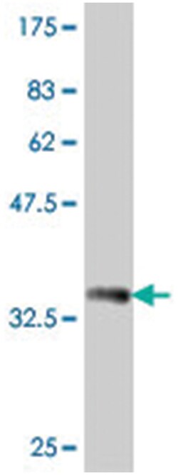 GSTT2, Mouse, Polyclonal Antibody, Abnova 50&mu;L; Unlabeled:Antibodies,
