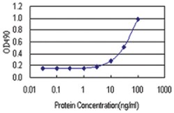 anti-GSTT2 Matched Antibody Pair, Abnova™