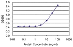 anti-GTF2E1, Human, Matched Antibody Pair, Abnova™