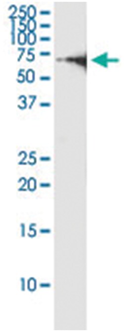 anti-GTF2E1, Human, IP-WB Antibody Pair, Abnova&trade;