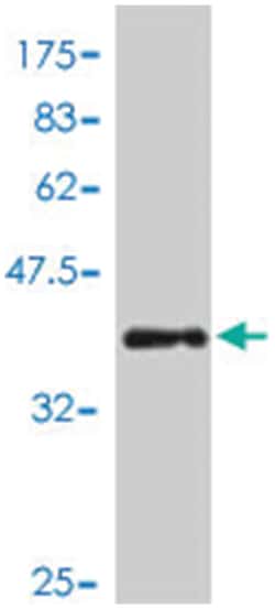 GTF2H1, Mouse, Polyclonal Antibody, Abnova 50 &mu;L | Buy Online | Abnova | Fisher Scientific