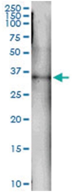 anti-GTF2H3, Human, IP-WB Antibody Pair, Abnova 1 Set:Antibodies, Monoclonal/Polyclonal