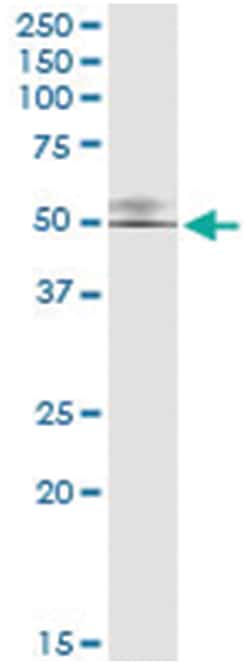 anti-GTF2H4, Human, IP-WB Antibody Pair, Abnova™