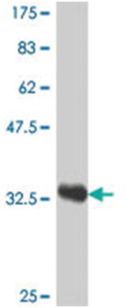 GTF3A, Mouse, Polyclonal Antibody, Abnova 50&mu;L; Unlabeled:Antibodies,