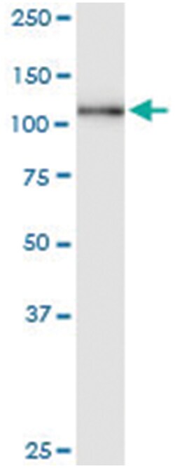 anti-GTF3C2, Human, IP-WB Antibody Pair, Abnova™