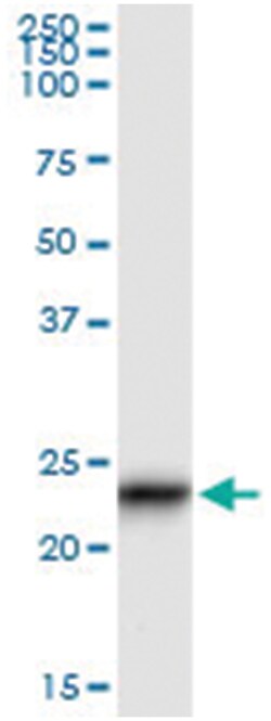 GUK1, Human, IP-WB Antibody Pair (PW3), Abnova™
