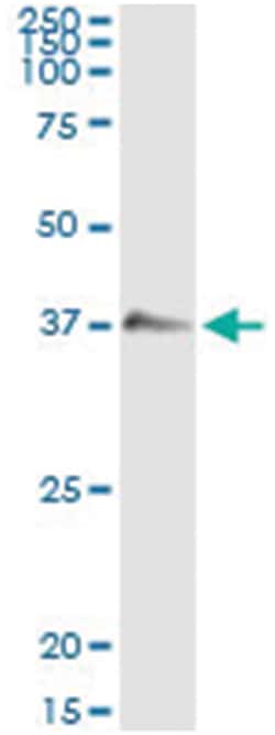 GZMB, Human, IP-WB Antibody Pair (PW1), Abnova&trade;