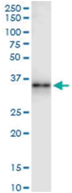 GZMB, Human, IP-WB Antibody Pair (PW2), Abnova&trade;