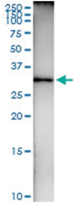 HADH, Human, IP-WB Antibody Pair (PW1), Abnova 1 Set:Antibodies, Monoclonal/Polyclonal