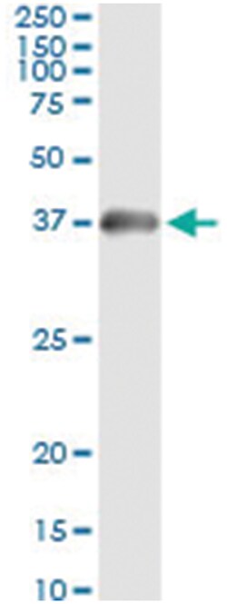 HADH, Human, IP-WB Antibody Pair (PW2), Abnova™