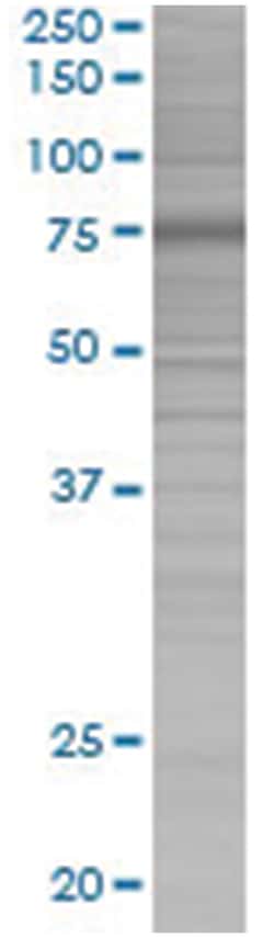 HAL 293T Cell Overexpression Lysate (Denatured), Abnova