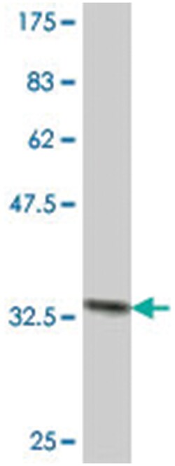 HBQ1, Mouse, Polyclonal Antibody, Abnova 50&mu;L; Unlabeled:Antibodies,
