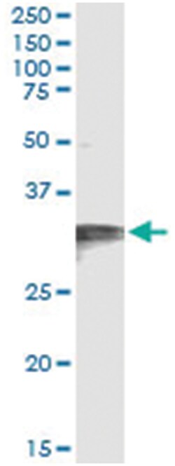 anti-HCCS, Human, IP-WB Antibody Pair, Abnova&trade;