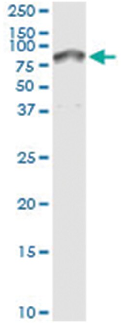 anti-SERPIND1, Human, IP-WB Antibody Pair, Abnova&trade;
