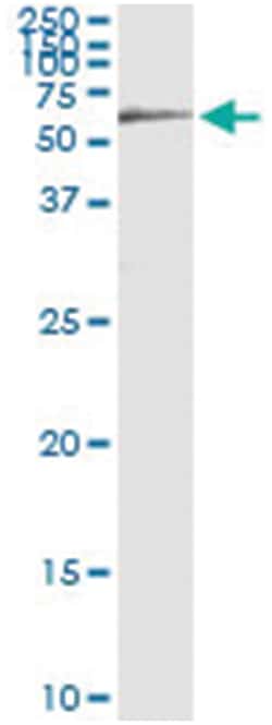 HCK, Human, IP-WB Antibody Pair (PW1), Abnova&trade;