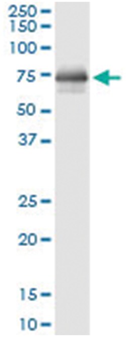 HCK, Human, IP-WB Antibody Pair (PW2), Abnova™