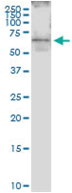 anti-HCRTR2, Human, IP-WB Antibody Pair, Abnova&trade;