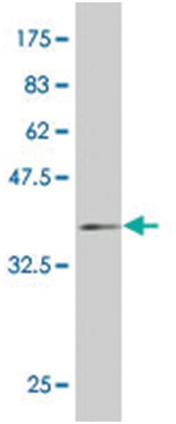 HD, Mouse, Clone: 1A12, Abnova 100&mu;g; Unlabeled:Antibodies, Monoclonal