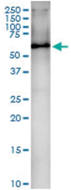 anti-HDAC1, Human, IP-WB Antibody Pair, Abnova 1 Set:Antibodies, Monoclonal/Polyclonal