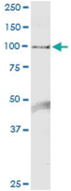 anti-HELLS, Human, IP-WB Antibody Pair, Abnova&trade;