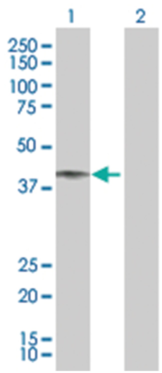 HFE 293T Cell Overexpression Lysate (Denatured), Abnova 100μL:Protein ...