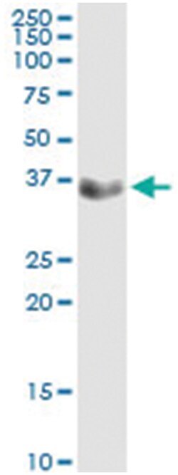 anti-CFHR1, Human, IP-WB Antibody Pair, Abnova&trade;