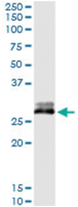 anti-CFHR2, Human, IP-WB Antibody Pair, Abnova&trade;