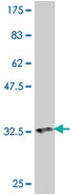 HGD, Mouse, Polyclonal Antibody, Abnova 50 &mu;L | Buy Online | Abnova | Fisher Scientific