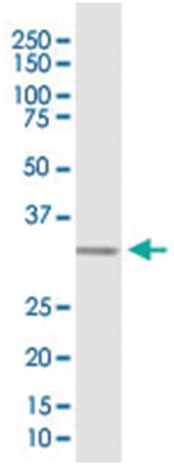 anti-NRG1, Human, IP-WB Antibody Pair, Abnova&trade;
