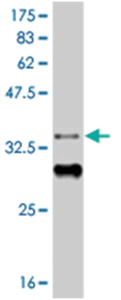 HIC1, Mouse, Clone: 1F2, Abnova 100&mu;g; Unlabeled:Antibodies, Monoclonal