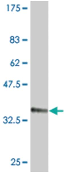 HIC1, Mouse, Clone: 2B9, Abnova 100&mu;g; Unlabeled:Antibodies, Monoclonal