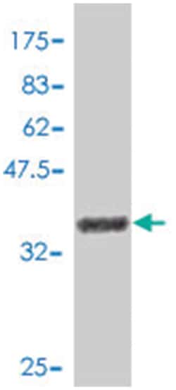 HIF1A, Mouse, Polyclonal Antibody, Abnova 50&mu;L; Unlabeled:Antibodies,