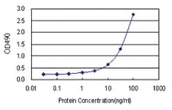 anti-HIP1 Ab-2 Matched Antibody Pair, Abnova™