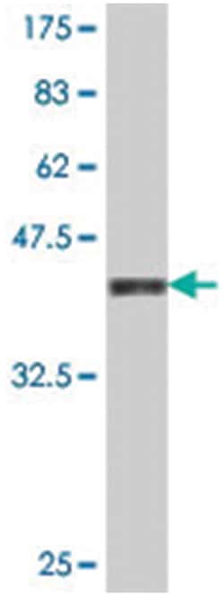 HK1, Mouse, Polyclonal Antibody, Abnova 50&mu;L; Unlabeled:Antibodies,