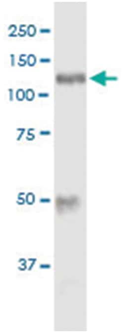 HK1, Human, IP-WB Antibody Pair (PW2), Abnova&trade;
