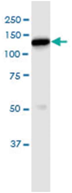 HK1, Human, IP-WB Antibody Pair (PW3), Abnova&trade;