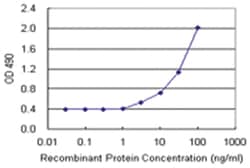 anti-HLA-A Matched Antibody Pair, Abnova™